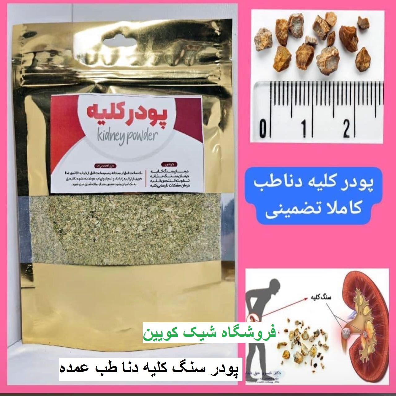 کرم لیفتینگ دنا طب